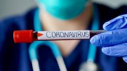 Breaking News : Lampaui Puncak Delta, Kasus Harian Positif Covid-19 Capai 57.049 Orang