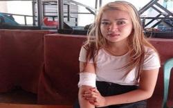 Dikejar sampai Dekat Polda Sumsel, Gadis Muda Ini Kena Sabetan Celurit Geng Motor<
