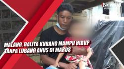 Video Balita Kurang Mampu Hidup Tanpa Lubang Anus di Maros