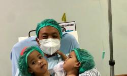 Menunggu 3 Tahun, Bayi Kembar Siam Inaya dan Anaya Akhirnya Sukses lewati Operasi Pemisahan