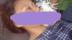 Viral Wanita Cantik Manado Kena Panah Wayer di Pipi saat Keluar Cari Makan   