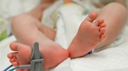 Mengenal Rakha, Balita yang Berjuang Sembuh usai Operasi Pengangkatan Tumor di Pipi