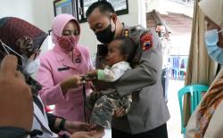  Momen Haru Kapolres Banjarnegara Gendong Anak Penderita Tumor Mata Sebesar Bola Tenis 