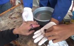 Datang dengan Jari Membengkak, Pria Ini Minta Damkar Potong Cincin dari Laher Motor