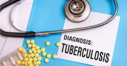 Tuberkulosis Meningkat Selama Pandemi Covid-19, Menkes Angkat Isu TB di Forum G20