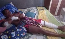 Duel Lawan Buaya, Pria Ini Selamat meski Dapat 135 Jahitan di Tubuh