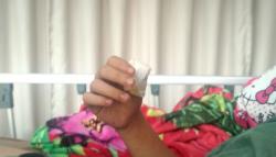 Dibacok Orang Tak Dikenal, Pemuda di Majalengka Hilang Ibu Jari<