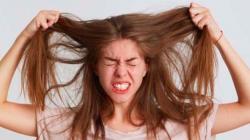 4 Cara Menghilangkan Ketombe Membandel dan Gatal Paling Ampuh, Bisa Pakai Cuka Sari Apel hingga Minyak Kelapa  