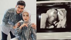 Ria Ricis Tunjukkan Wajah Calon Buah Hati, Bagian Ini Jadi Sorotan