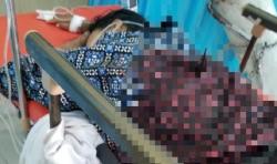 Siti Badriah Dibegal saat Berkendara, Senjata Tajam Masih Menancap di Punggung<