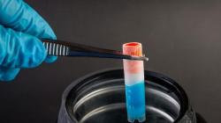 Angka Perkawinan di Singapura Rendah, Perempuan Kurang Semangat Berhubungan Seks