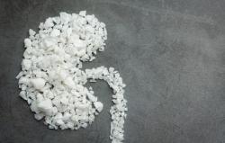 Dokter UGM Ingatkan Bahaya Konsumsi Suplemen Berlebihan, Apa Alasannya?