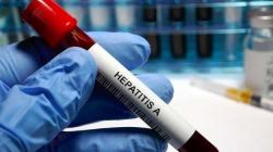 Epidemiolog UGM Pastikan Tidak Ada Kaitan Hepatitis Akut dengan Vaksin Covid-19
