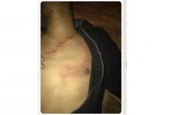 Pulang Nonton Voli, 2 Remaja di Gunungkidul Kena Sabetan Gir <