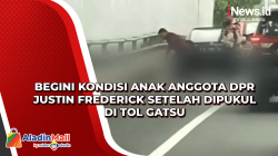 Begini Kondisi Anak Anggota DPR Justin Frederick Setelah Dipukul di Tol Gatsu