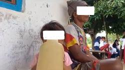  Kecanduan, Balita Ini Tiap Hari Hirup Aroma Bensin dari Botol