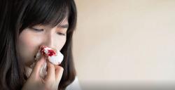 5 Manfaat Daun Sirih, Meredakan Mimisan hingga Mengontrol Gula Darah