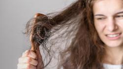 Ini 5 Penyebab Rambut Rontok Parah, Jangan Anggap Sepele!