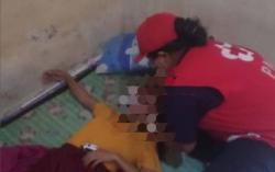 Mulut Berbusa, Cewek di Bali Nyaris Kehilangan Nyawa Tenggak Kapur Barus