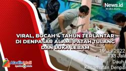 Viral, Bocah 4 Tahun Terlantar di Denpasar Alami Patah Tulang dan Luka Lebam