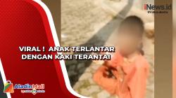 Viral !  Anak Telantar Dengan Kaki Terantai