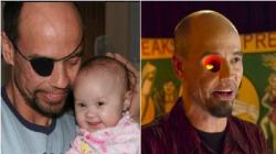 Billy Owen, Pria Unik yang Bisa Memasukkan Jari dari Mulut ke Mata