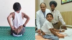 Arshid Ali Khan, Pria India yang Punya Ekor di Punggungnya dan Disembah Bagai Dewa