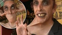 Gary Turner, Pria yang Mempunyai Kulit Karet / Elastis Asal Inggris hingga Bisa Dilipat