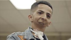 Isaiah Acosta, Pria Tanpa Rahang yang Tak Bisa Bicara tetapi Sukses Jadi Rapper