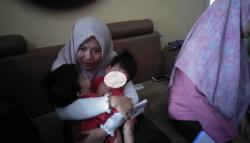 Sempat Sakit, Bayi Kembar Siam asal KBB Masih Tunggu Operasi Pemisahan<