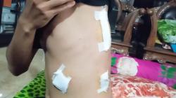 Tegur Pria Rusak Dekorasi 17-an, Pemuda di Palembang Malah Kena Tusuk<