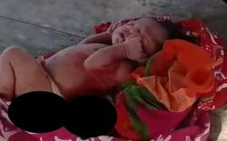 Pilu, Bayi Masih Hidup dengan Tali Pusar Utuh Dibuang di Gubuk Warga