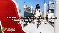 Nyakim Gatwech, Model Cantik yang Dinobatkan sebagai Manusia Paling Gelap di Dunia