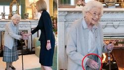 Dokter Ini Menilai Kesehatan Ratu Elizabeth II Menurun, Tampak dari Punggung Tangan