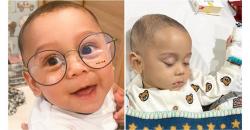 Baby L Anak Lesti Kejora dan Rizky Billar Operasi Hernia, Banjir Doa dari Selebriti