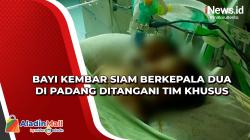 Bayi Kembar Siam Berkepala Dua di Padang Ditangani Tim Khusus