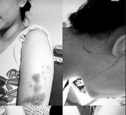 Pengakuan Korban Penganiayaan Polwan di Pekanbaru, Dijambak dan Disekap