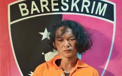 Gondrong, Ini Tampang Suami Siram Muka Istri Pakai Air Keras di Muara Enim 
