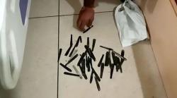 Dokter Terkejut Ada 63 Sendok di Dalam Perut Pria Ini, Awalnya Dikira Tumor