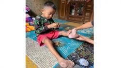 Anak 7 Tahun di Sukabumi Tanpa Anus dan Kelamin Butuh Biaya Pengobatan<