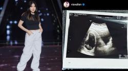 Usia 2 Bulan Janin dalam Kandungan Via Vallen Jantungnya Tak Berdetak, Ini Penjelasan Dokter 