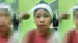 Mama Muda Dirampok saat Sendiri di Rumah, Kepala Dihantam Balok hingga Dapat 19 Jahitan