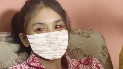 Pilu, Korban Tragedi Kanjuruhan Ini Hilang Ingatan Usai Koma 3 Hari, Matanya Memerah