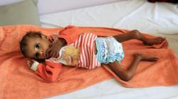 Ngeri, FAO Prediksi Hampir 1 Juta Orang di Negara Ini Terancam Kelaparan