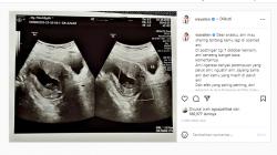 Via Vallen Curhat Pilu tentang Janinnya yang Tidak Berkembang, Harus Digugurkan?