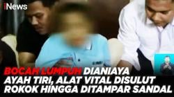 Bocah Lumpuh Dianiaya Ayah Tiri, Alat Vital Disulut Rokok hingga Ditampar Sandal 