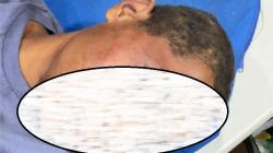 Pomdam XVII/Cenderawasih Usut Dugaan Oknum TNI AD Aniaya 3 Warga Sipil