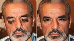 Valery Smagliy, Pria Pemilik Bulu Mata Terpanjang Asal Ukraina