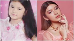 Intip 4 Potret Masa Lalu Tiara Andini Sebelum Bersama Alshad Ahmad, Nomor 1 Paling Menggemaskan!