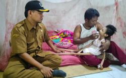 Kasus Gizi Buruk di Indramayu, Remaja 15 Tahun Kurus Kering dan Tak Bisa Bicara 
